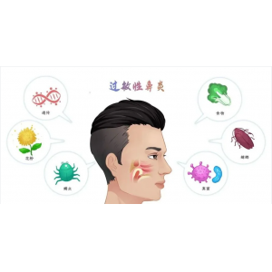 銘仁耳鼻喉專(zhuān)家分享：如何一招解決過(guò)敏性鼻炎的打噴嚏流鼻涕！