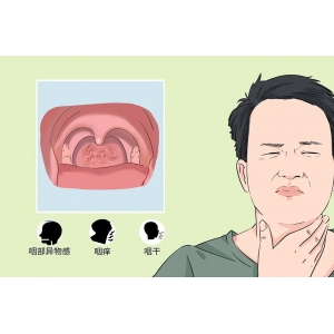 孩子咽干、喉部有異物感，警惕可能是慢性咽炎惹的禍！