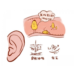 耳朵里耳屎多，到底要不要掏，正確處理方式是？