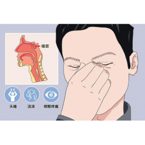 頭疼、眼痛雖小，卻可能是蝶竇炎發(fā)出的警告信號(hào)！