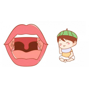 孩子扁桃體為何頻繁發(fā)炎？