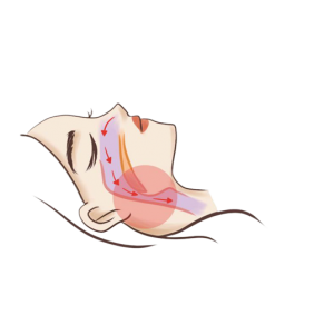 銘仁微創(chuàng)治療治好“呼嚕娃”，讓孩子不在打鼾！