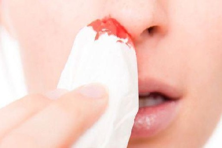 (貴陽(yáng)治療鼻炎的醫(yī)院在哪里)貴陽(yáng)什么醫(yī)院治療鼻炎最好(圖2)