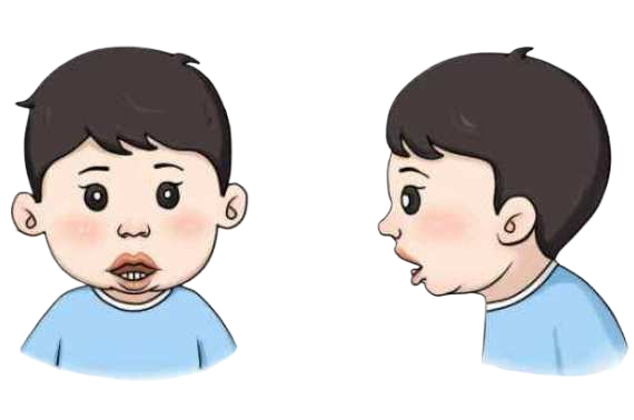 孩子打呼嚕是睡得香？注意可能是鼾癥惹的禍(圖2)