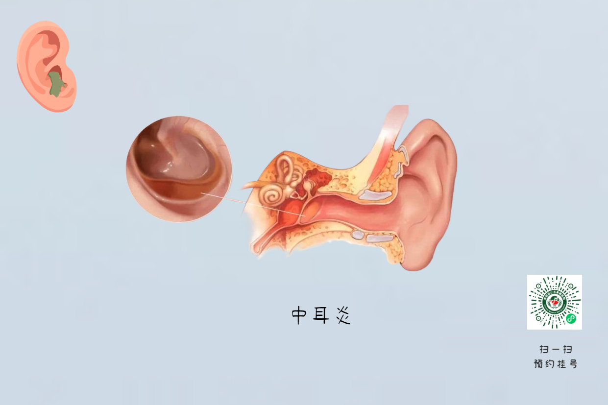 手術(shù)沒做干凈，術(shù)后3年顱內(nèi)竟發(fā)現(xiàn)巨大膽脂瘤！(圖4)