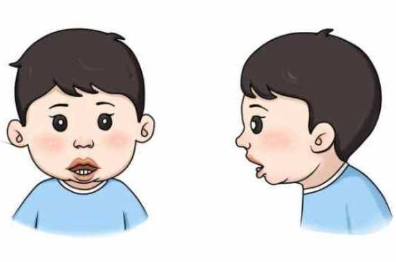 專家分享：父母注意！孩子腺樣體肥大如果忽略，后果很嚴重！(圖2)