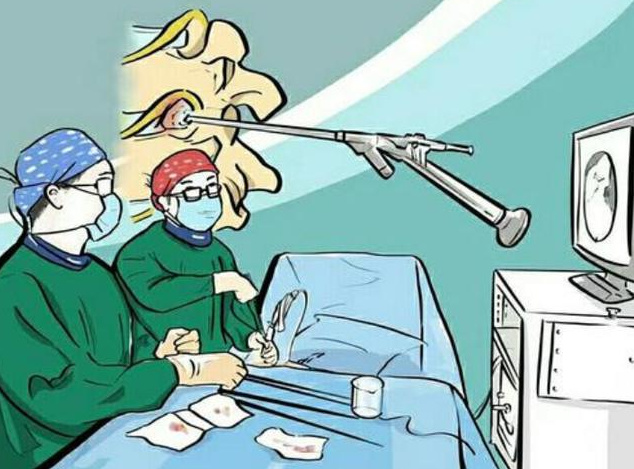 慢性中耳炎不會(huì)自愈，拖久了可能會(huì)導(dǎo)致耳聾！(圖3)