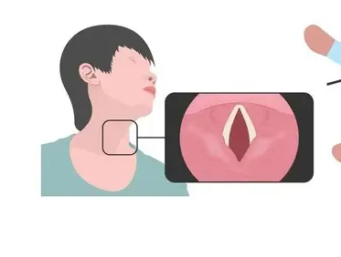 耳鼻喉分享：嘶啞聲不一定是上火，要警惕這些疾病！(圖3)