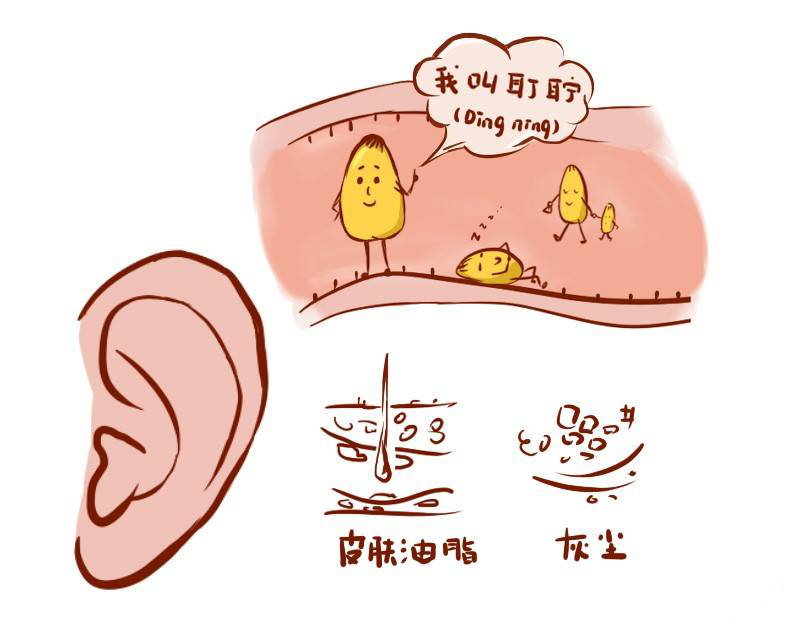 關(guān)于中耳炎的5個(gè)常見問題，你一定要知道！(圖2)