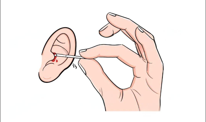 孩子老喊耳朵疼，是怎么回事？(圖3)