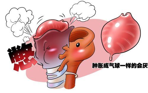 會厭囊腫并非小毛病，嚴重會引起窒息？(圖1)