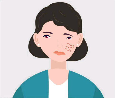 中耳炎會(huì)引起面癱，是真的嗎？(圖3)