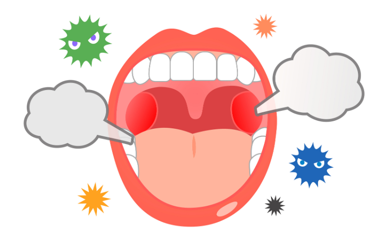 咽炎，喉炎，咽喉炎有什么區(qū)別？(圖2)