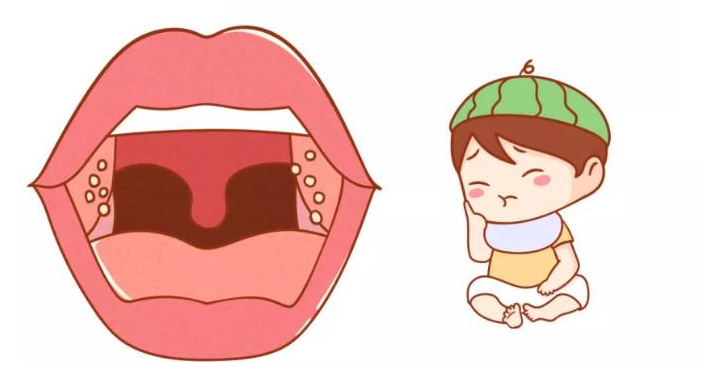 孩子扁桃體為何頻繁發(fā)炎？(圖1)