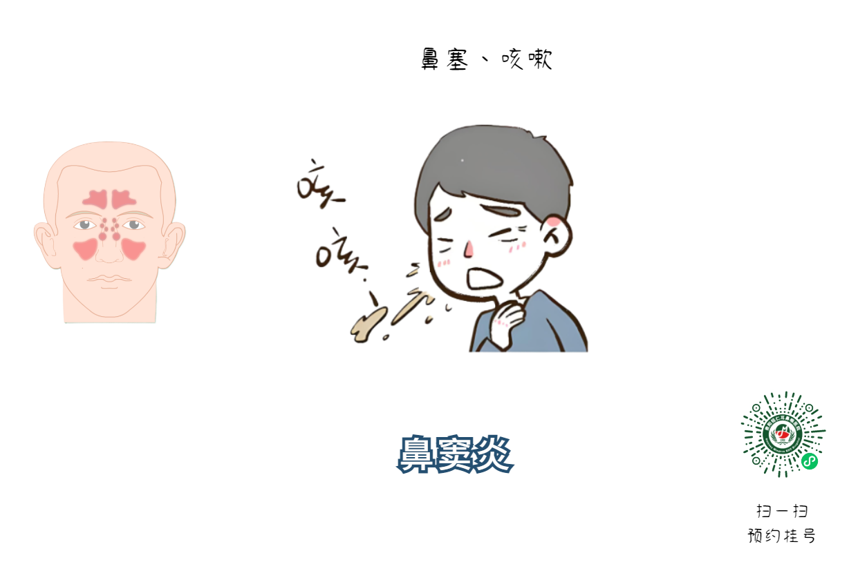 鼻炎與鼻竇炎，兩者之間有什么聯(lián)系？(圖3)