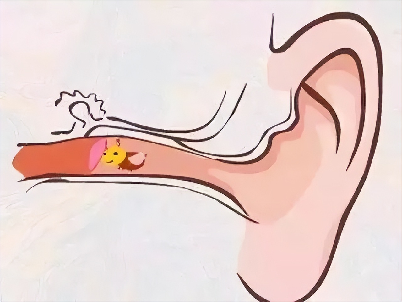 耳鳴耳聾，千萬別大意，勿讓小病變大病(圖2)