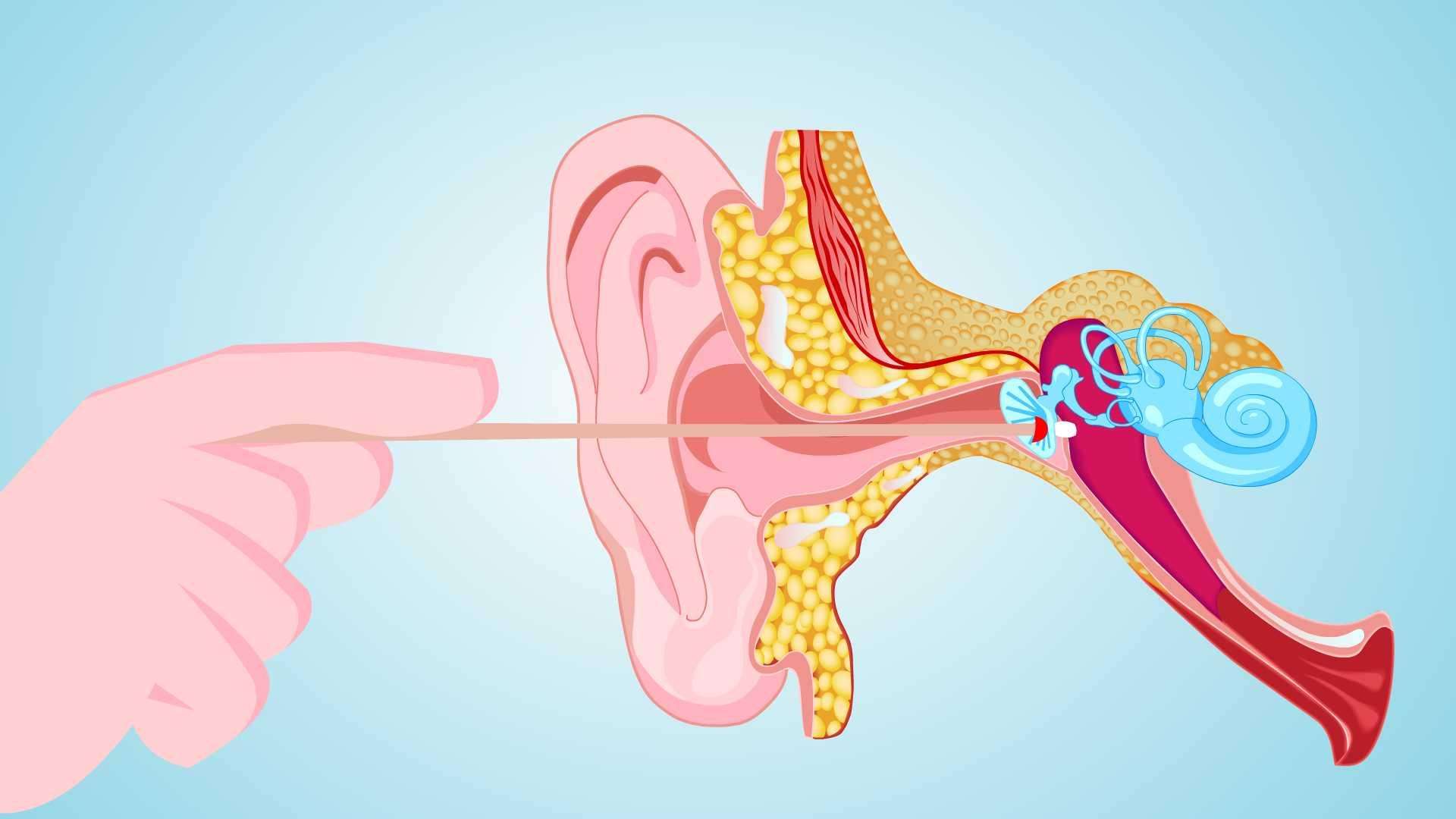 耳朵流膿、耳痛、聽(tīng)力下降？中耳炎及時(shí)治療會(huì)怎樣？(圖1)