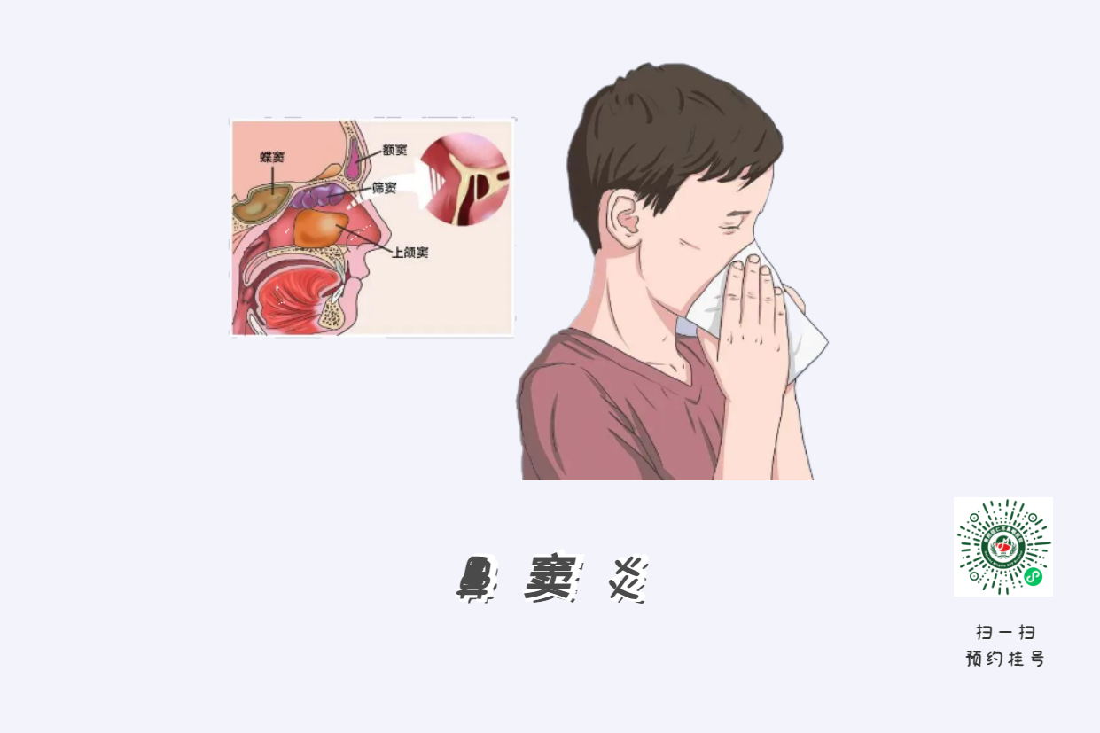 鼻竇炎為什么會(huì)頭痛？(圖2)