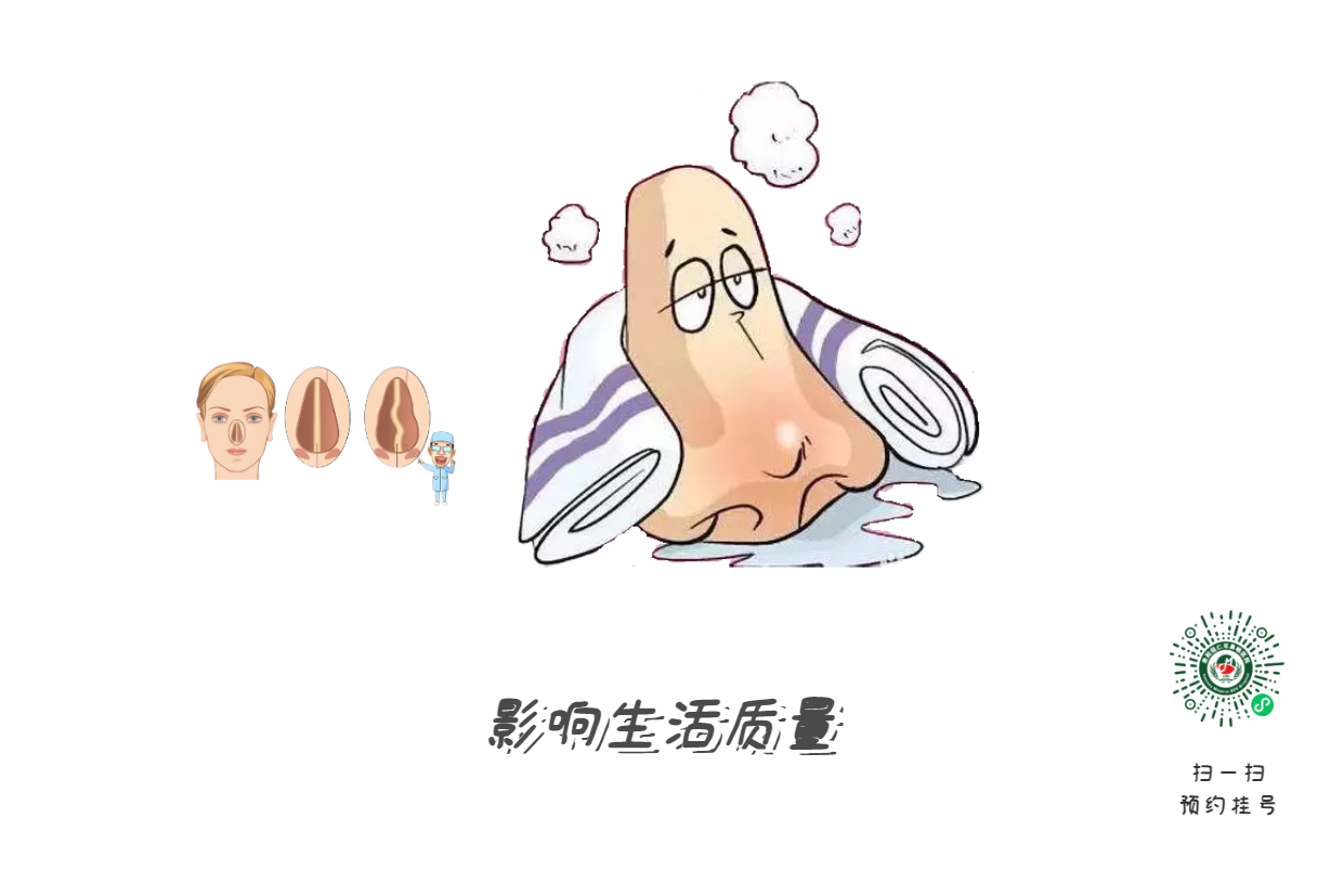 鼻塞、流涕、打噴嚏，是鼻炎引起的？注意可能是鼻中隔偏曲！(圖2)