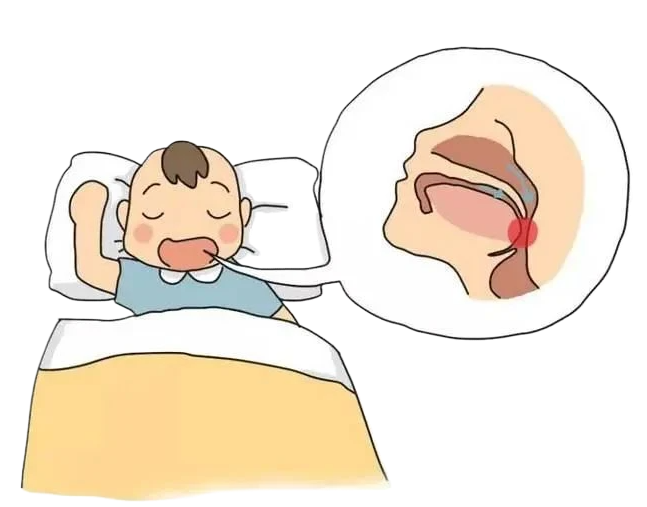 腺樣體手術風險大嗎？麻醉會影響孩子智商嗎？(圖2)