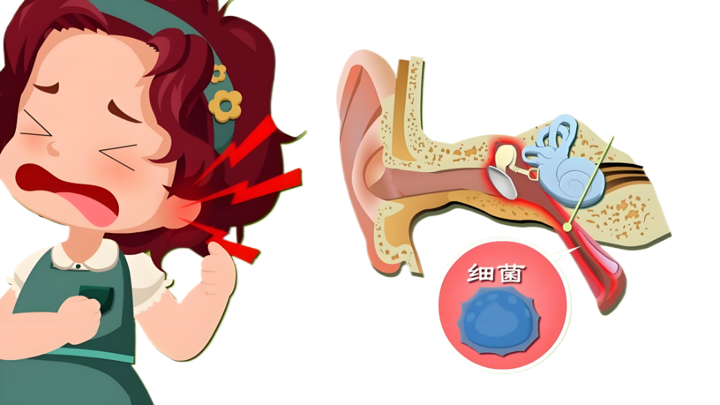 感冒引發(fā)分泌性中耳炎，會導(dǎo)致聽力下降？(圖2)