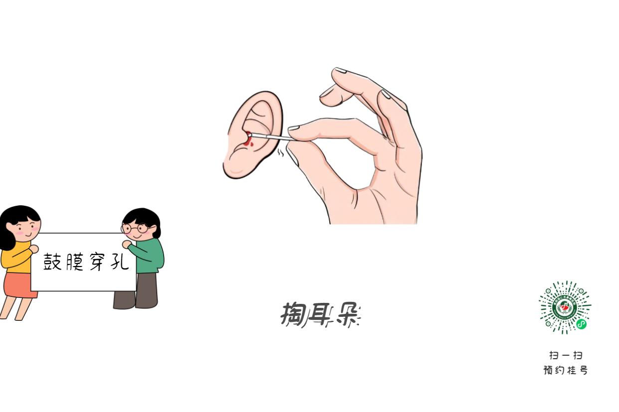 掏耳朵竟致顱內(nèi)感染？這5個習(xí)慣快改掉(圖1)