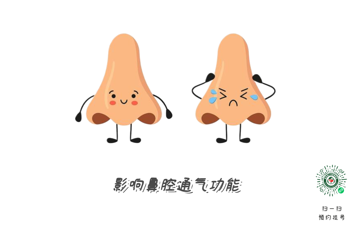 鼻中隔偏曲必須手術？符合這標準再決定(圖2)