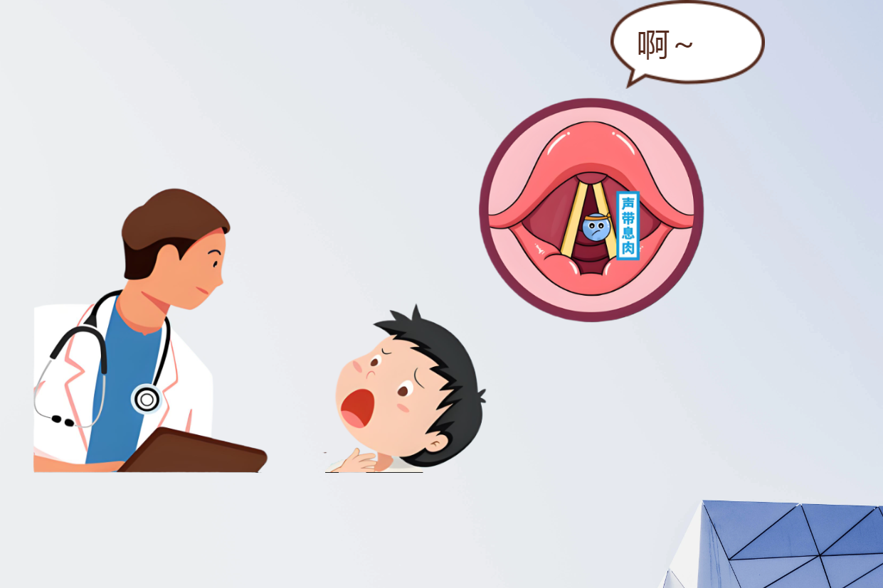 長期清嗓子？可能是聲帶息肉早期信號(圖2)