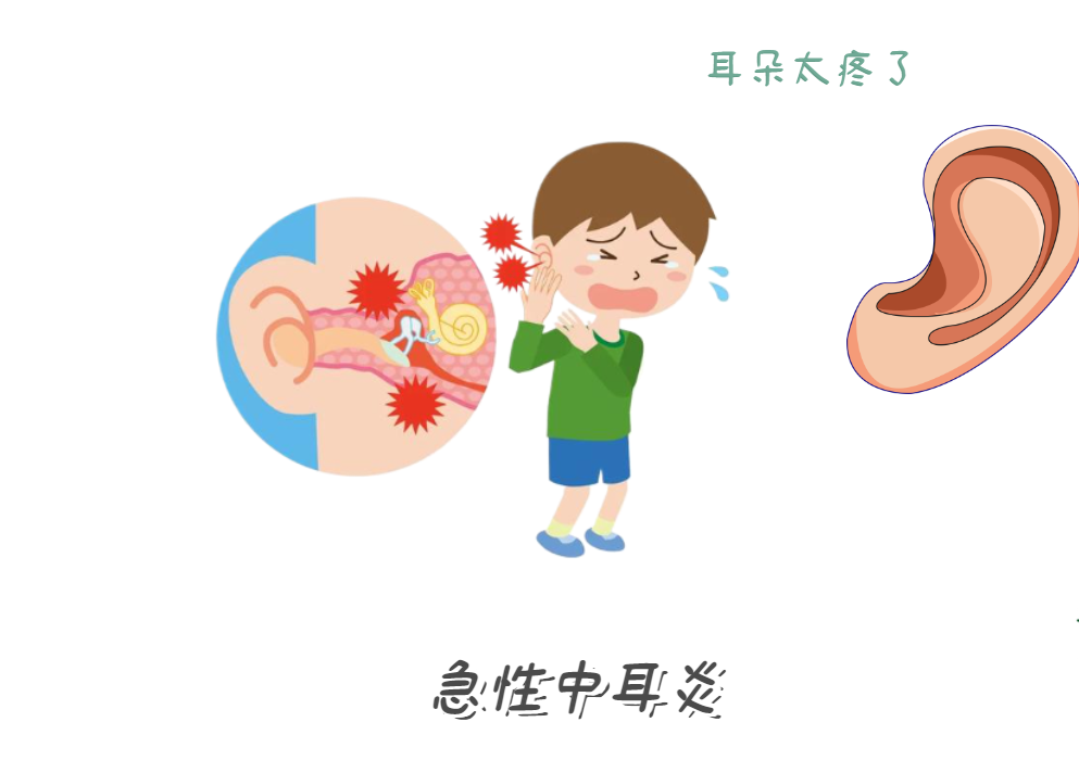 耳朵痛到睡不著？急性中耳炎急救法！(圖1)