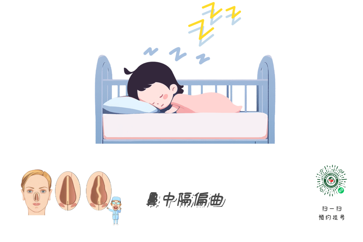 孩子打呼=睡得香？腺樣體警報！(圖3)