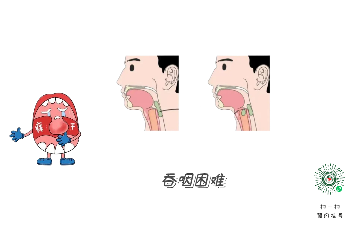 嗓子啞了別大意，可能是聲帶在“報(bào)警”(圖2)